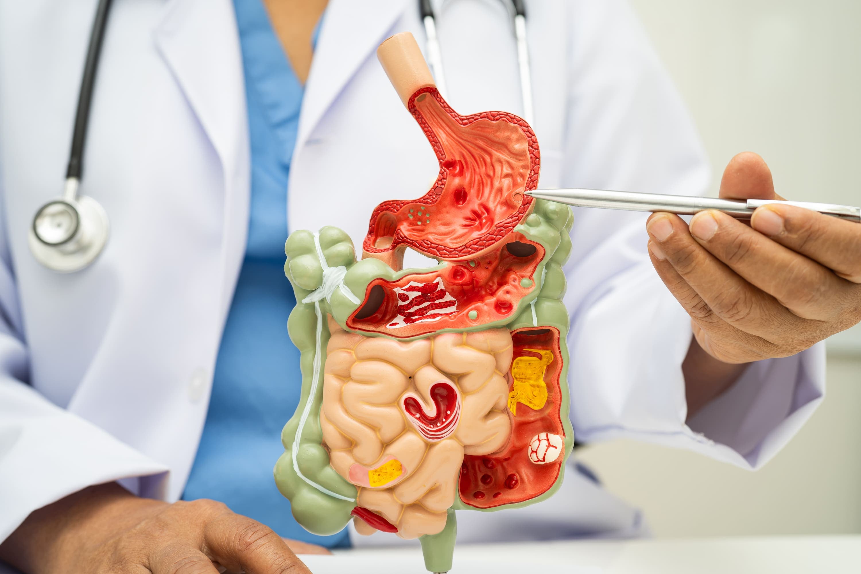 Università San Raffaele Master Di Secondo Livello Gastroenterologia Dalla Teoria Alla Pratica Fad